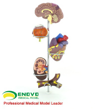 HEART21(12497) Medical Anatomical Human Hypertension Model